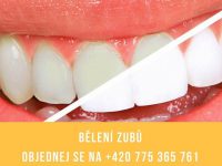 Zářivý úsměv nemusí být jen snem. U nás bude o Vaš…