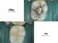 Dnešní PŘED a PO!  Šikovné ruce naší doktorky Mari…